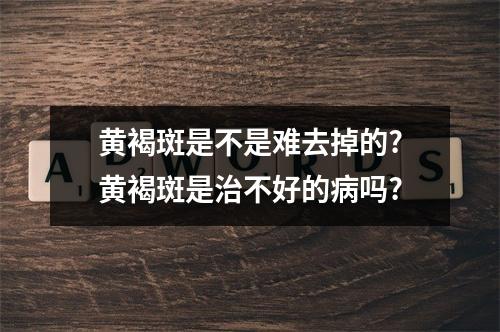 黄褐斑是不是难去掉的?黄褐斑是治不好的病吗?