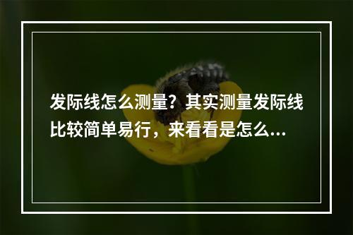 发际线怎么测量？其实测量发际线比较简单易行，来看看是怎么做的吧？