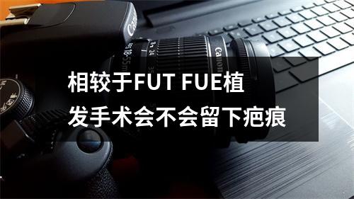 相较于FUT FUE植发手术会不会留下疤痕