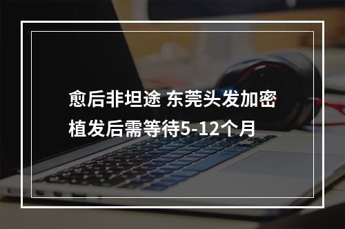 愈后非坦途 东莞头发加密植发后需等待5-12个月