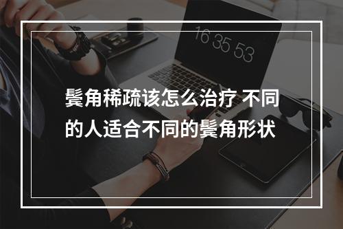 鬓角稀疏该怎么治疗 不同的人适合不同的鬓角形状