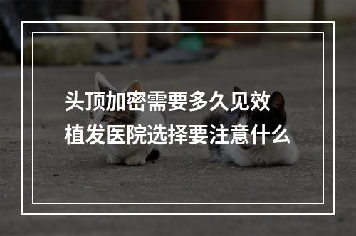 头顶加密需要多久见效 植发医院选择要注意什么