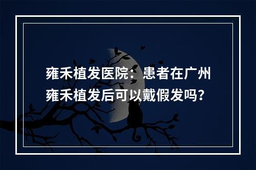 雍禾植发医院：患者在广州雍禾植发后可以戴假发吗？