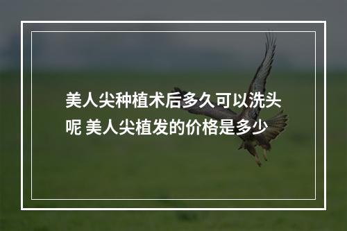 美人尖种植术后多久可以洗头呢 美人尖植发的价格是多少