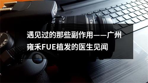 遇见过的那些副作用——广州雍禾FUE植发的医生见闻