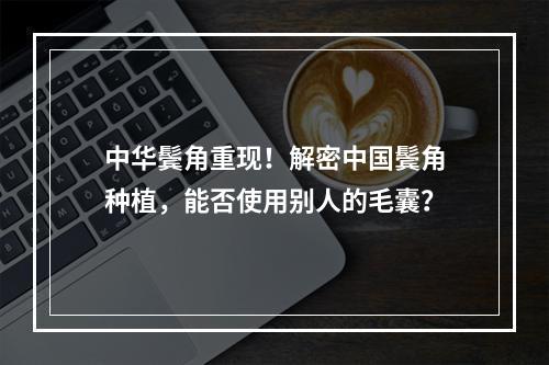 中华鬓角重现！解密中国鬓角种植，能否使用别人的毛囊？