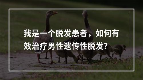 我是一个脱发患者，如何有效治疗男性遗传性脱发？