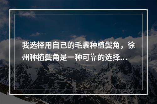 我选择用自己的毛囊种植鬓角，徐州种植鬓角是一种可靠的选择吗？