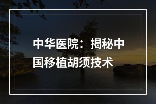 中华医院：揭秘中国移植胡须技术