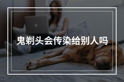 鬼剃头会传染给别人吗