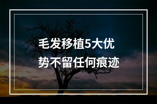 毛发移植5大优势不留任何痕迹