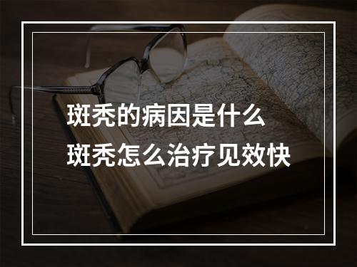 斑秃的病因是什么 斑秃怎么治疗见效快