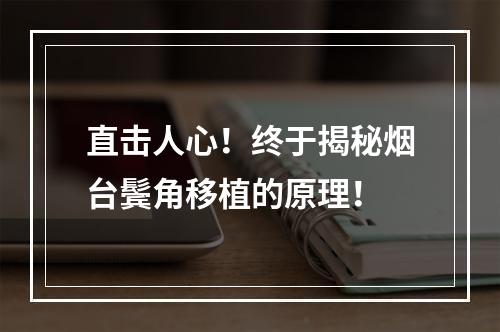 直击人心！终于揭秘烟台鬓角移植的原理！