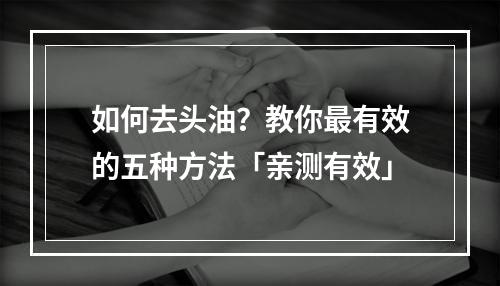 如何去头油？教你最有效的五种方法「亲测有效」