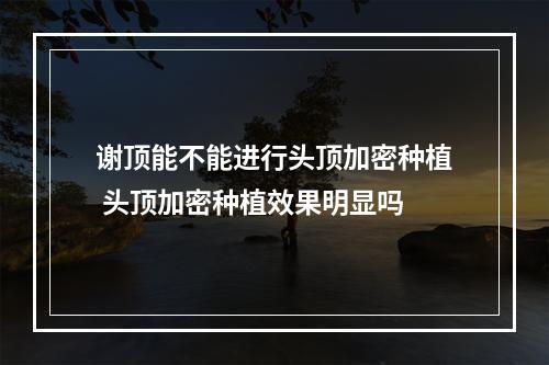 谢顶能不能进行头顶加密种植 头顶加密种植效果明显吗