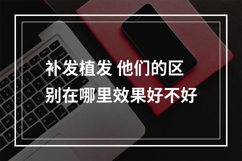 补发植发 他们的区别在哪里效果好不好