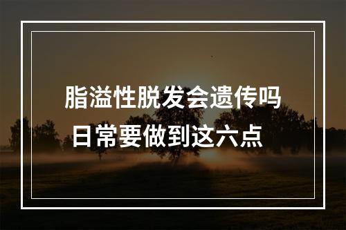 脂溢性脱发会遗传吗 日常要做到这六点