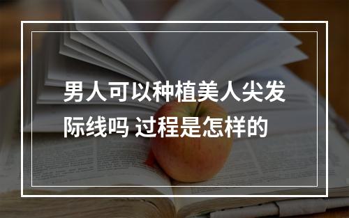 男人可以种植美人尖发际线吗 过程是怎样的