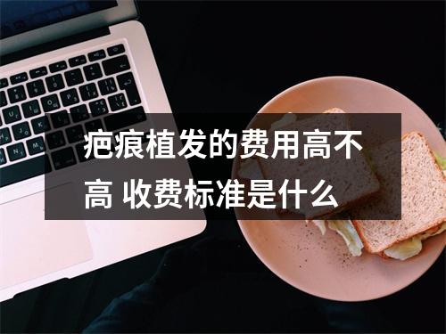 疤痕植发的费用高不高 收费标准是什么