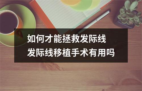 如何才能拯救发际线  发际线移植手术有用吗