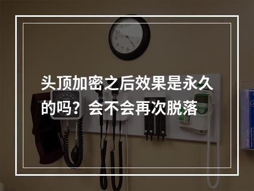 头顶加密之后效果是永久的吗？会不会再次脱落