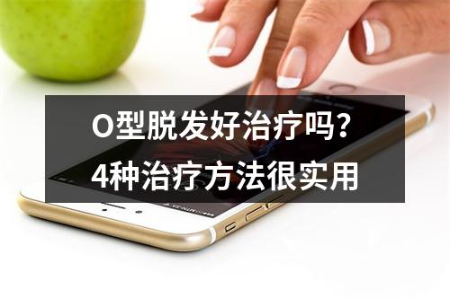 O型脱发好治疗吗？4种治疗方法很实用