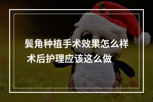 鬓角种植手术效果怎么样 术后护理应该这么做