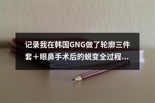 记录我在韩国GNG做了轮廓三件套＋眼鼻手术后的蜕变全过程 术后朋友都说我美的自然