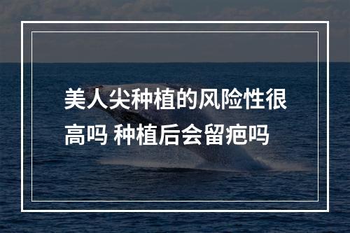 美人尖种植的风险性很高吗 种植后会留疤吗