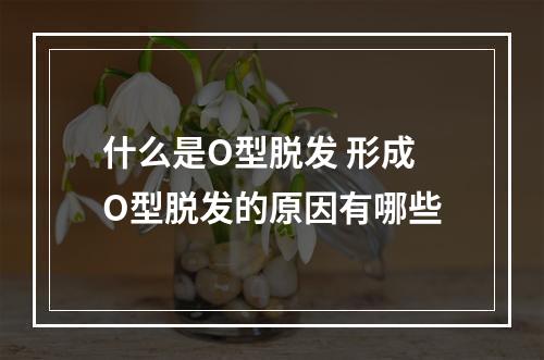 什么是O型脱发 形成O型脱发的原因有哪些