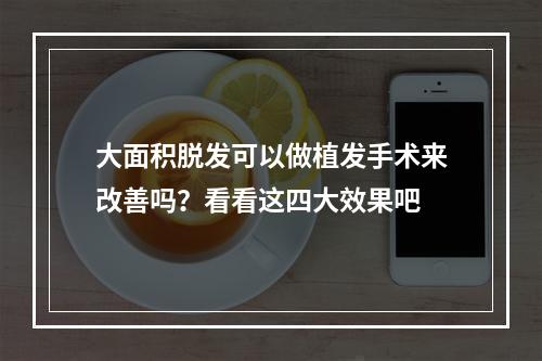 大面积脱发可以做植发手术来改善吗？看看这四大效果吧