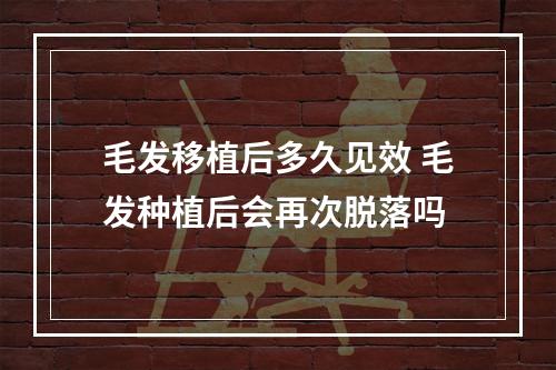 毛发移植后多久见效 毛发种植后会再次脱落吗