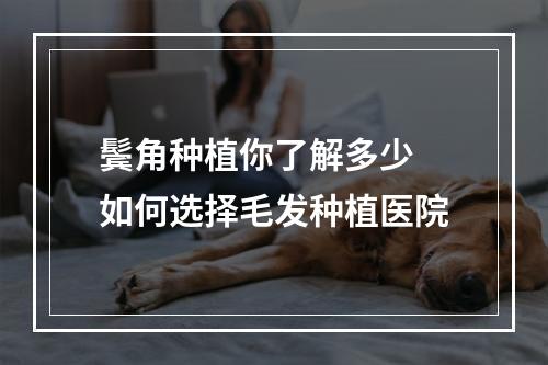 鬓角种植你了解多少 如何选择毛发种植医院