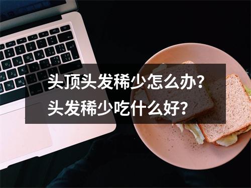 头顶头发稀少怎么办？头发稀少吃什么好？