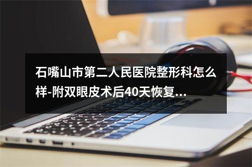 石嘴山市第二人民医院整形科怎么样-附双眼皮术后40天恢复果图