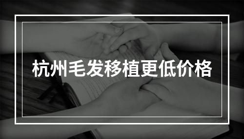 杭州毛发移植更低价格