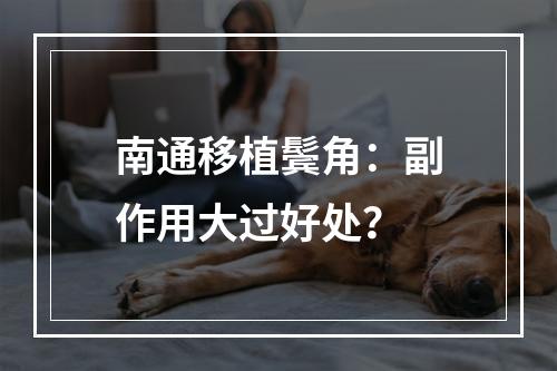 南通移植鬓角：副作用大过好处？