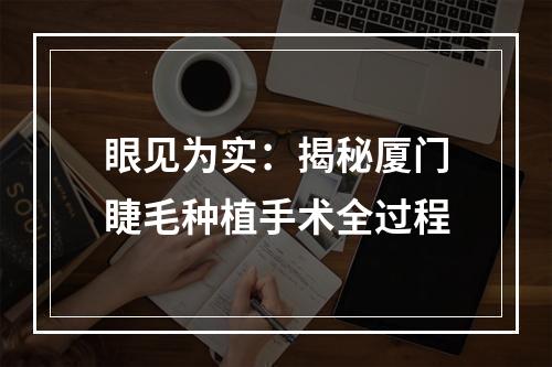 眼见为实：揭秘厦门睫毛种植手术全过程