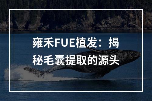 雍禾FUE植发：揭秘毛囊提取的源头