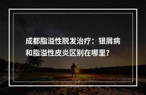 成都脂溢性脱发治疗：银屑病和脂溢性皮炎区别在哪里？