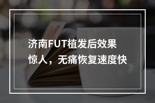 济南FUT植发后效果惊人，无痛恢复速度快