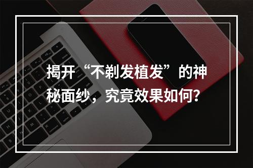 揭开“不剃发植发”的神秘面纱，究竟效果如何？