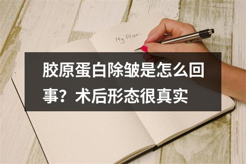 胶原蛋白除皱是怎么回事？术后形态很真实