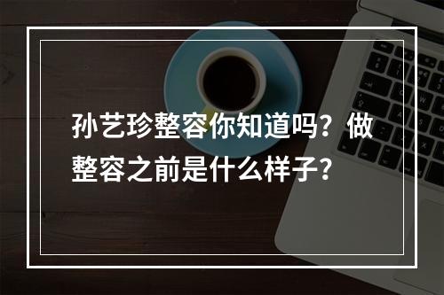 孙艺珍整容你知道吗？做整容之前是什么样子？