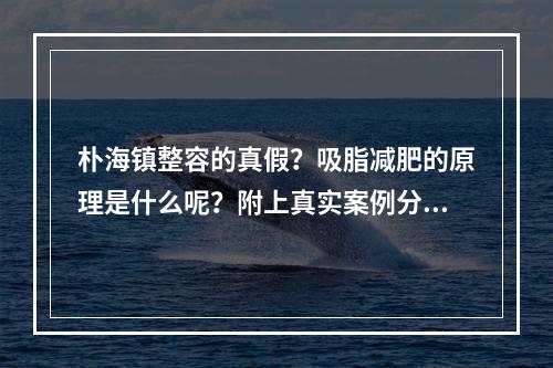 朴海镇整容的真假？吸脂减肥的原理是什么呢？附上真实案例分享！