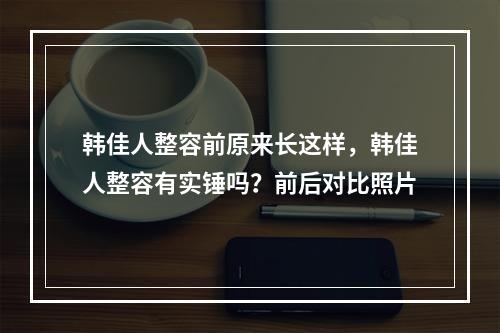 韩佳人整容前原来长这样，韩佳人整容有实锤吗？前后对比照片