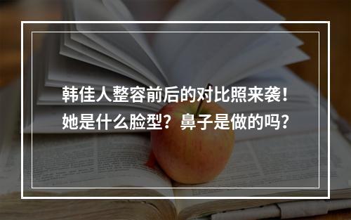 韩佳人整容前后的对比照来袭！她是什么脸型？鼻子是做的吗？