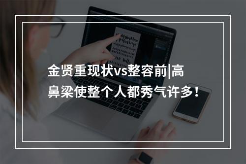 金贤重现状vs整容前|高鼻梁使整个人都秀气许多！