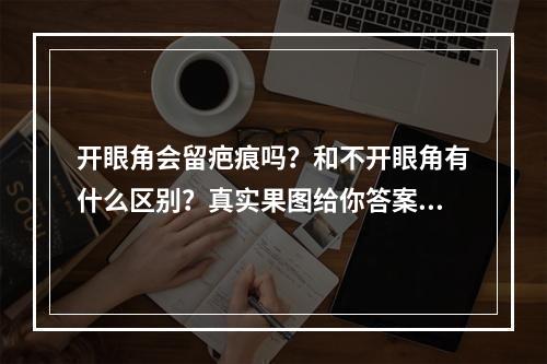 开眼角会留疤痕吗？和不开眼角有什么区别？真实果图给你答案！