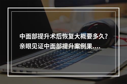 中面部提升术后恢复大概要多久？亲眼见证中面部提升案例果...